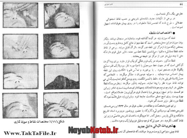 دانلود کتاب مبانی و اصول طب سوزنی چینی - Image 3